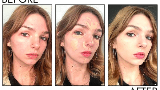 Консилер для лікування акне